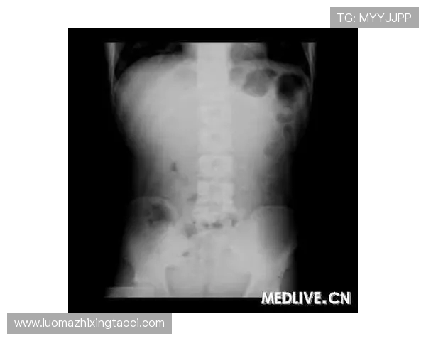 加比亚磁共振检查结果公布肌肉和肌腱损伤可能性已被排除